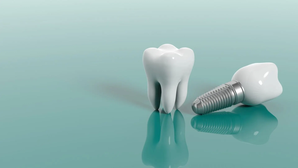 Implant Dentistry